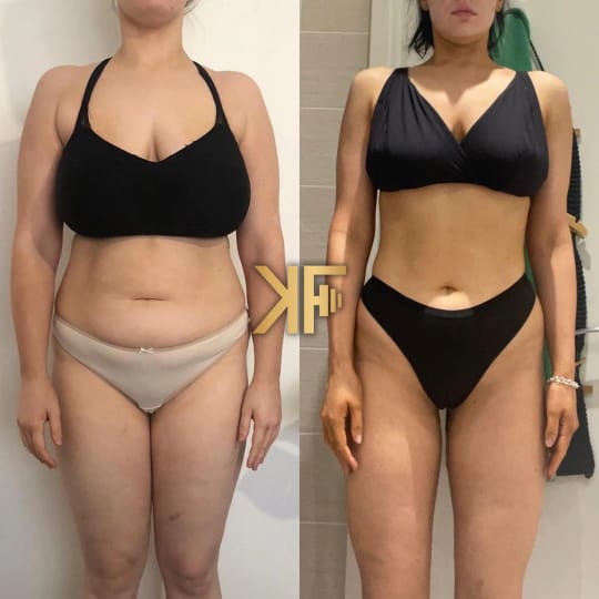 Voor- en na-foto van een klant van KEVFIT